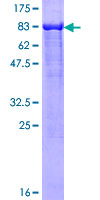 SDS-PAGE - Recombinant Human LONRF2 protein (AB165771)