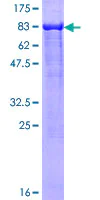 SDS-PAGE - Recombinant Human LONRF2 protein (AB165771)