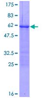 SDS-PAGE - Recombinant Human Loricrin protein (AB114261), expandable thumbnail