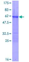 SDS-PAGE - Recombinant Human Loricrin protein (AB114261)