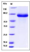 SDS-PAGE - Recombinant Human Low-density lipoprotein receptor-related protein 10 (His tag) (AB276515)