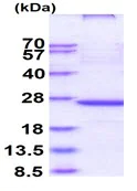 SDS-PAGE - Recombinant Human LOX 1 protein (denatured) (AB111627)