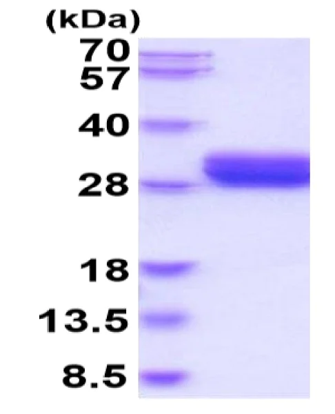 SDS-PAGE - Recombinant Human LOX 1 protein (His tag) (AB222959)