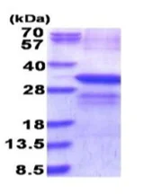 SDS-PAGE - Recombinant Human LOX protein (denatured) (His tag N-Terminus) (AB187448)