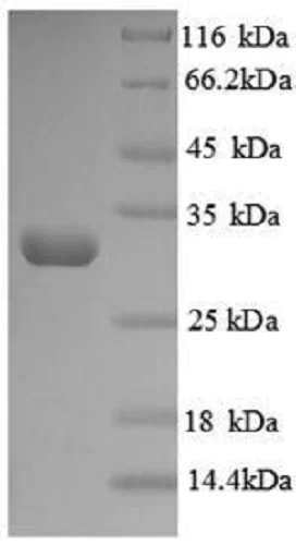 SDS-PAGE - Recombinant Human LOX protein (His tag) (AB240764)