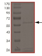 SDS-PAGE - Recombinant Human LOXL1 protein (AB172190), expandable thumbnail
