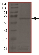 Recombinant Human LOXL2 protein