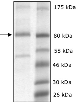 SDS-PAGE - Recombinant Human LOXL2 protein (His tag) (AB198452), expandable thumbnail