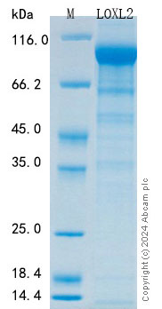 SDS-PAGE - Recombinant Human LOXL2 Protein Standard (His tag) (AB316539), expandable thumbnail