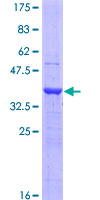 SDS-PAGE - Recombinant Human LOXL4 protein (AB153549), expandable thumbnail