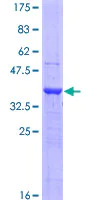 SDS-PAGE - Recombinant Human LOXL4 protein (AB153549)