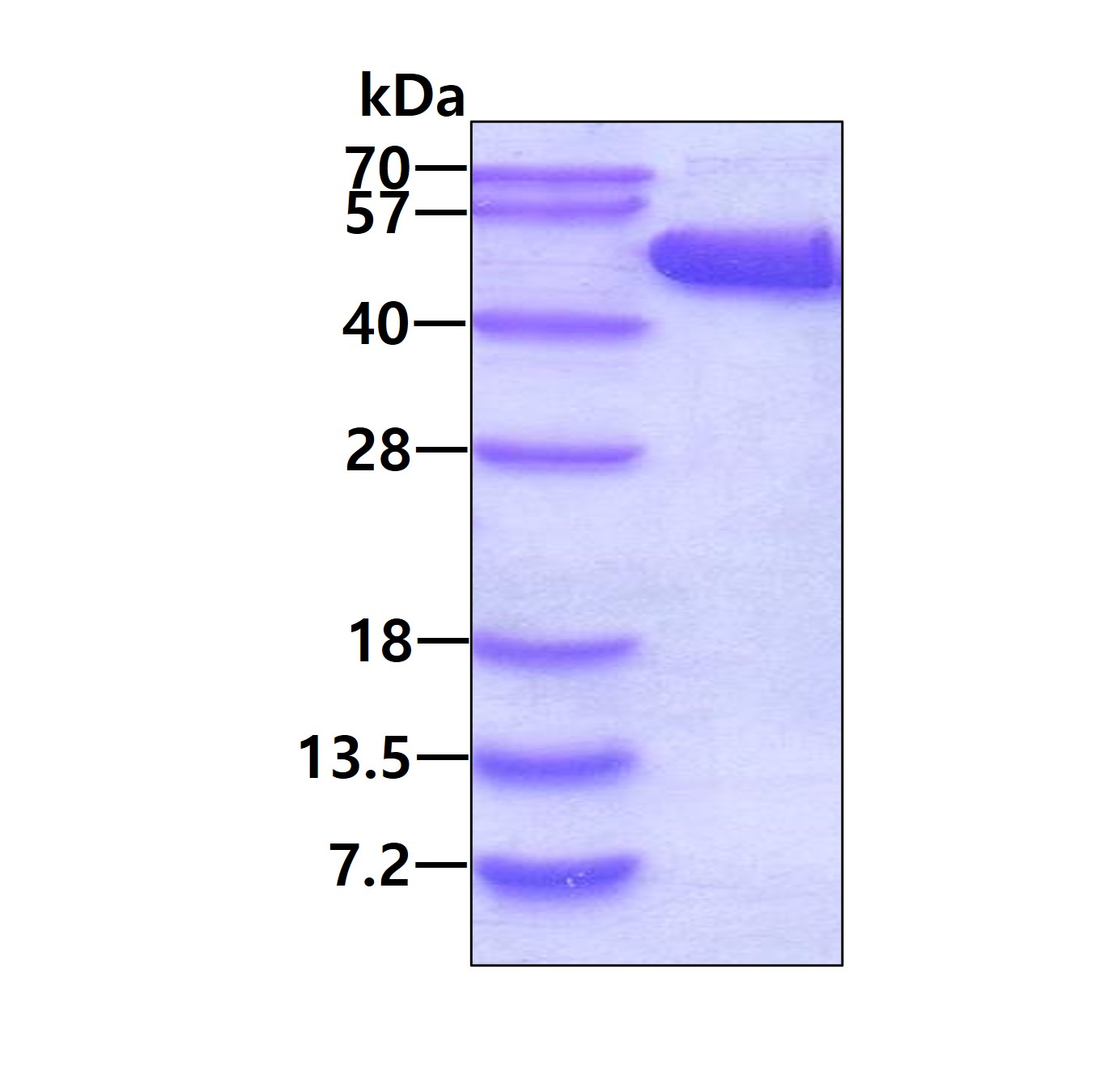 SDS-PAGE - Recombinant Human LPAP protein (His tag N-Terminus) (AB202618)