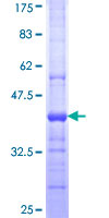 SDS-PAGE - Recombinant Human LPLA2 protein (AB161739)