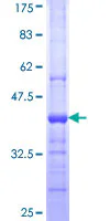 SDS-PAGE - Recombinant Human LPLA2 protein (GST tag N-Terminus) (AB161739)