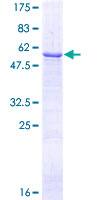 SDS-PAGE - Recombinant Human LRP1 protein (AB158828)
