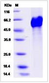 SDS-PAGE - Recombinant Human LRP11 protein (His tag) (AB276603), expandable thumbnail