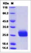 SDS-PAGE - Recombinant Human LRP15 protein (His tag) (AB276639)