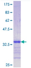 Recombinant Human LRP5 protein