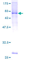 Recombinant Human LRRC17 protein