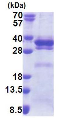 SDS-PAGE - Recombinant Human LRRC59 protein (His tag N-Terminus) (AB171695)