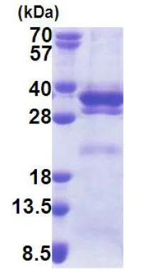SDS-PAGE - Recombinant Human LRRC59 protein (His tag N-Terminus) (AB171695)