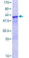 SDS-PAGE - Recombinant Human LRRK1 protein (AB164085)