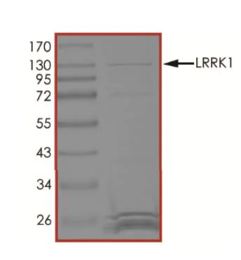 SDS-PAGE - Recombinant human LRRK1 protein (Active) (AB268732)