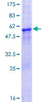 SDS-PAGE - Recombinant Human LRRK1 protein (GST tag N-Terminus) (AB164085)
