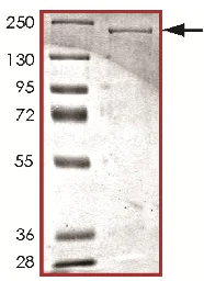 SDS-PAGE - Recombinant human LRRK2 protein (AB177261)