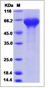 SDS-PAGE - Recombinant Human LRRTM2 protein (His tag) (AB276684)