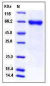 SDS-PAGE - Recombinant Human LRRTM4 protein (His tag) (AB276388)