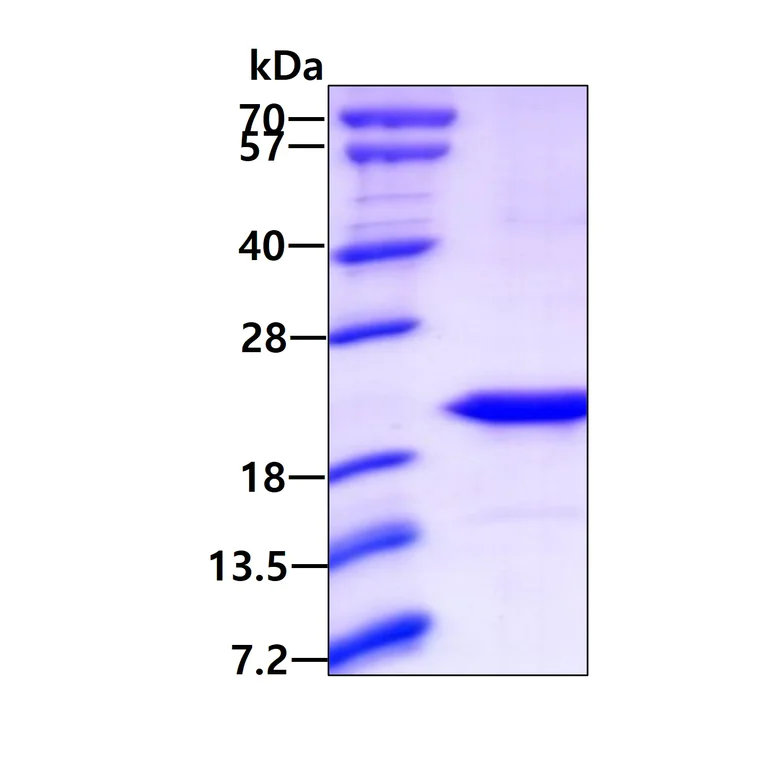 SDS-PAGE - Recombinant Human LSM1 protein (AB101157)