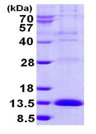 SDS-PAGE - Recombinant Human LSM2 protein (AB124544), expandable thumbnail