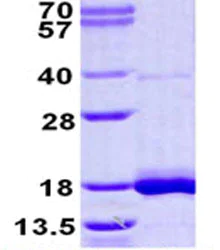 SDS-PAGE - Recombinant Human LSM3 protein (His tag N-Terminus) (AB124558)