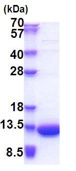 SDS-PAGE - Recombinant Human LSM5 protein (His tag N-Terminus) (AB171489)