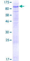 Recombinant Human LSR protein