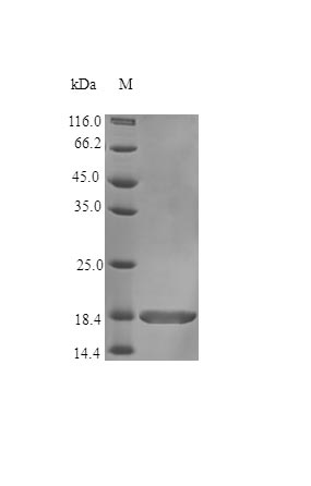 SDS-PAGE - Recombinant human LTA protein (Active) (AB243774)