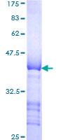 SDS-PAGE - Recombinant Human LTBP1 protein (AB114738)