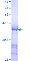 SDS-PAGE - Recombinant Human LTBP1 protein (GST tag N-Terminus) (AB114738)