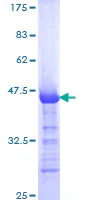 SDS-PAGE - Recombinant Human LTBP2 protein (AB158832)