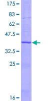 SDS-PAGE - Recombinant Human LTC4S protein (AB158833)