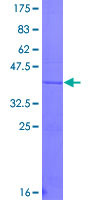 SDS-PAGE - Recombinant Human Lubricin/MSF protein (AB153060), expandable thumbnail