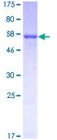 SDS-PAGE - Recombinant Human Lumican protein (GST tag N-Terminus) (AB114635)
