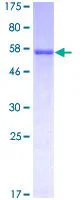 SDS-PAGE - Recombinant Human Lumican protein (GST tag N-Terminus) (AB114635)