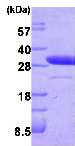 SDS-PAGE - Recombinant Human LXN/TCI protein (AB87145), expandable thumbnail