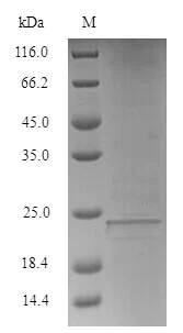 SDS-PAGE - Recombinant Human LY6E/SCA-2 protein (Tagged) (AB238242)