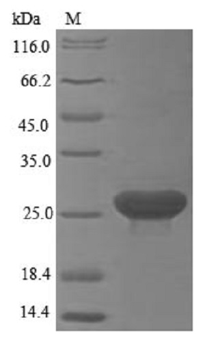 SDS-PAGE - Recombinant Human LY6G6D protein (Tagged) (AB235809)