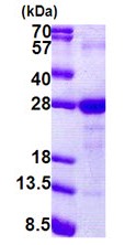 SDS-PAGE - Recombinant Human LY6G6F protein (denatured) (AB168082), expandable thumbnail