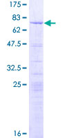 SDS-PAGE - Recombinant Human LYAR protein (AB163160), expandable thumbnail