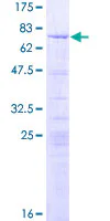 SDS-PAGE - Recombinant Human LYAR protein (AB163160)